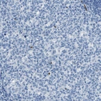 Immunohistochemical staining of human tonsil shows no positivity in germinal center cells as expected.