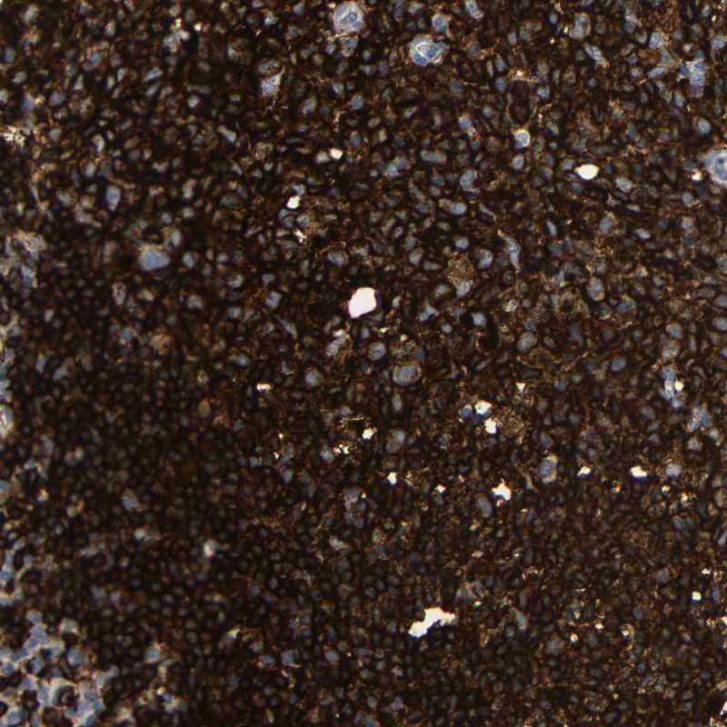 Anti-HLA-DQB1 Antibody