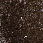 Anti-HLA-DQB1 Antibody
