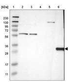 Lane 1: Marker [kDa] 230, 130, 95, 72, 56, 36, 28, 17, 11_br/_Lane 2: Human cell line RT-4_br/_Lane 3: Human cell line U-251MG sp_br/_Lane 4: Human plasma (IgG/HSA depleted)_br/_Lane 5: Human liver tissue_br/_Lane 6: Human tonsil tissue