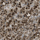 Anti-GNS Antibody