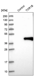 Western blot analysis in control (vector only transfected HEK293T lysate) and TOR1B over-expression lysate (Co-expressed with a C-terminal myc-DDK tag (~3.1 kDa) in mammalian HEK293T cells, LY415210).
