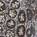 Immunohistochemical staining of human rectum shows strong cytoplasmic positivity in glandular cells.