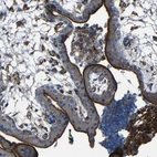 Immunohistochemical staining of human placenta shows strong positivity in microvilli in trophoblastic cells.