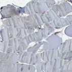 Immunohistochemical staining of human skeletal muscle shows no positivity in myocytes as expected.