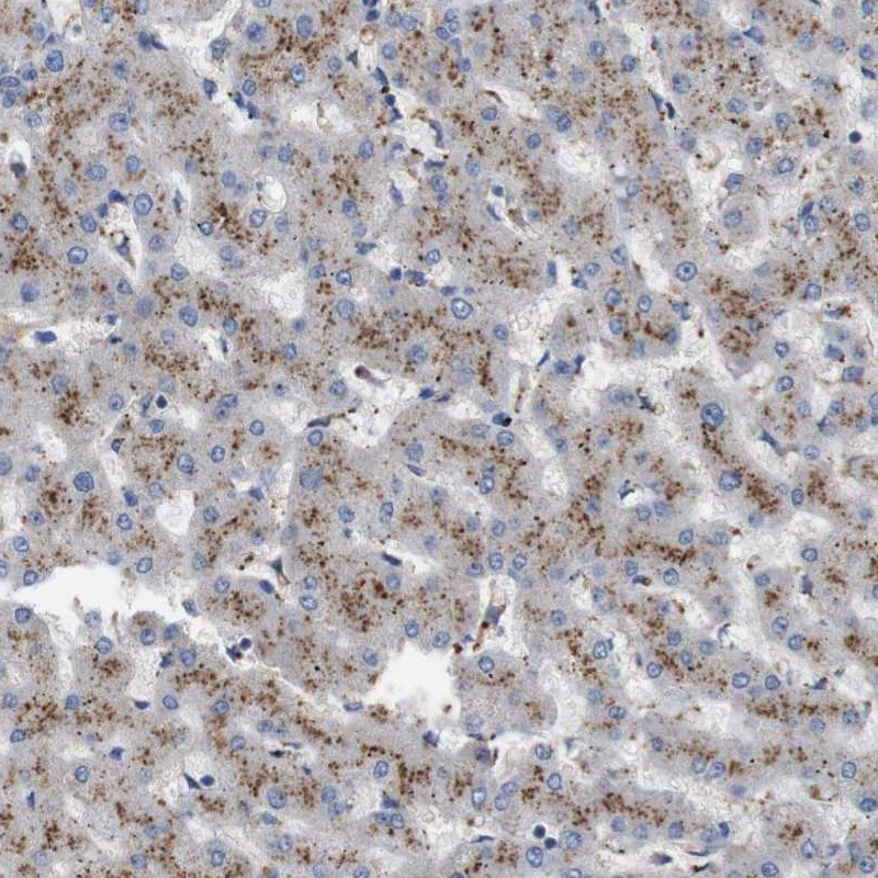 Anti-NHLRC3 Antibody