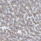 Anti-NHLRC3 Antibody