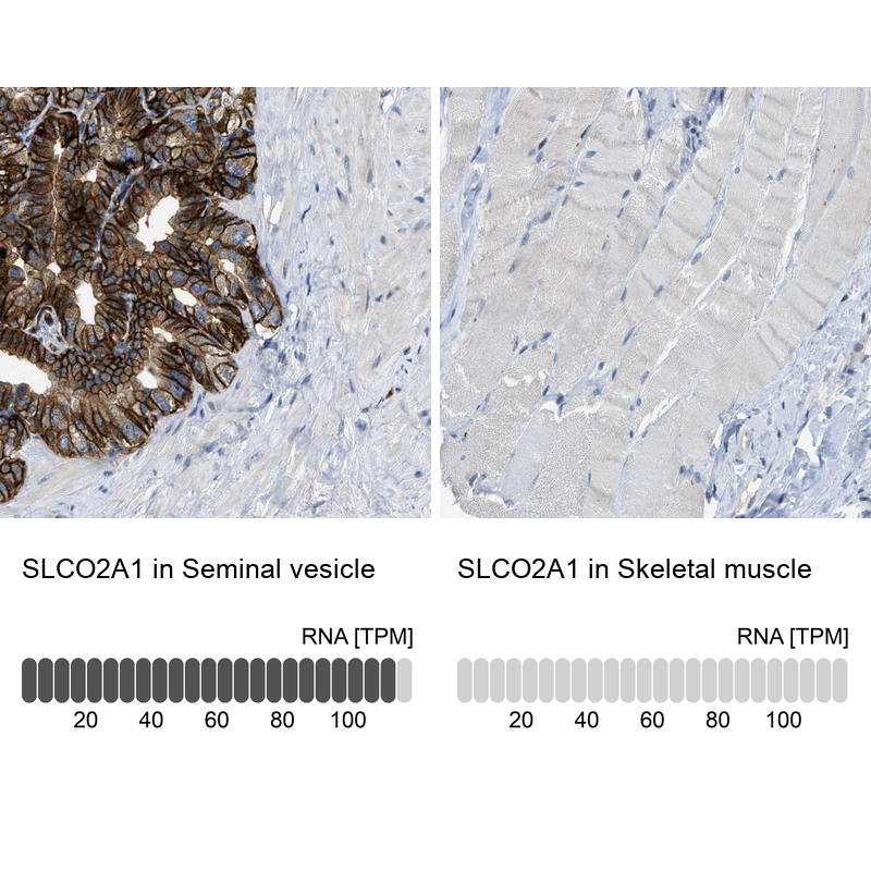 Anti-SLCO2A1 Antibody