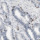 Immunohistochemical staining of human prostate shows strong membranous positivity in endothelial cells.