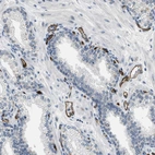 Immunohistochemical staining of human prostate shows strong membranous positivity in endothelial cells.