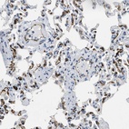 Immunohistochemical staining of human lung shows strong membranous positivity in endothelial cells.