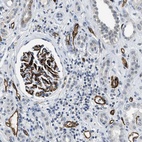 Immunohistochemical staining of human kidney shows strong membranous positivity in cells in glomeruli and endothelial cells.