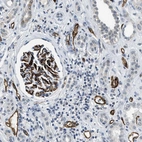 Immunohistochemical staining of human kidney shows strong membranous positivity in cells in glomeruli and endothelial cells.