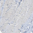 Immunohistochemical staining of human skeletal muscle shows no positivity as expected.