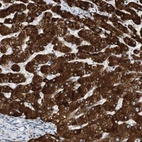 Immunohistochemical staining of human liver shows strong cytoplasmic and membranous positivity in hepatocytes.