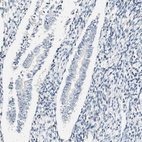 Immunohistochemical staining of human endometrium shows no positivity in glandular cells.