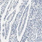 Immunohistochemical staining of human endometrium shows no positivity in glandular cells.