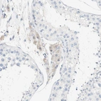 Immunohistochemical staining of human testis shows very weak positivity in Leydig cells.