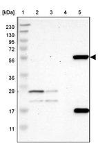 Lane 1: Marker [kDa] 230, 130, 95, 72, 56, 36, 28, 17, 11_br/_Lane 2: Human cell line RT-4_br/_Lane 3: Human cell line U-251MG sp_br/_Lane 4: Human plasma (IgG/HSA depleted)_br/_Lane 5: Human liver tissue