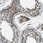 Immunohistochemical staining of human testis shows strong cytoplasmic positivity in Leydig cells and cells in the seminiferous duct.
