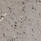 Immunohistochemical staining of human cerebral cortex shows strong cytoplasmic positivity in neurons.
