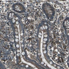 Immunohistochemical staining of human colon shows strong cytoplasmic positivity in glandular cells.