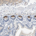 Immunohistochemical staining of human small intestine shows strong cytoplasmic positivity in glandular cells.
