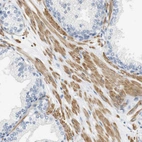 Immunohistochemical staining of human prostate shows strong cytoplasmic positivity in smooth muscle cells.