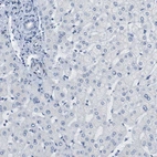Immunohistochemical staining of human liver shows no positivity in hepatocytes as expected.