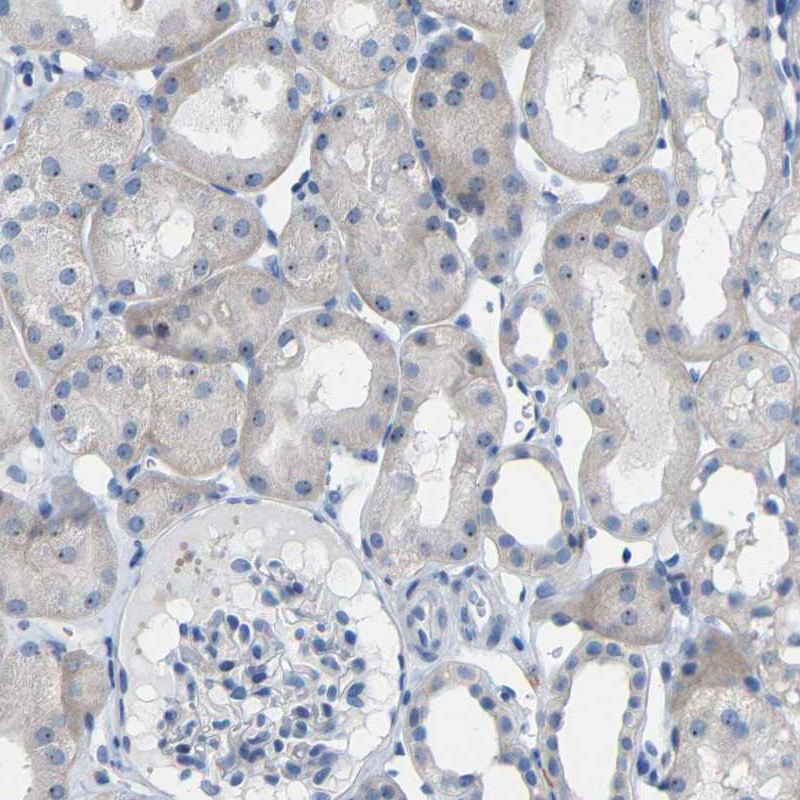 Anti-C1orf210 Antibody