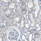 Anti-C1orf210 Antibody