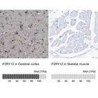 Anti-P2RY12 Antibody