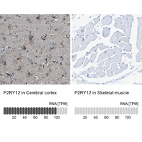Anti-P2RY12 Antibody