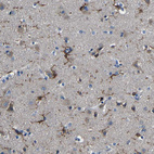 Anti-P2RY12 Antibody