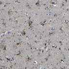 Immunohistochemical staining of human cerebral cortex shows strong positivity in microglia.