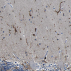 Immunohistochemical staining of human cerebellum shows strong positivity in microglia.