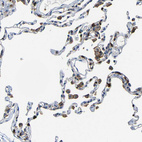 Immunohistochemical staining of human lung shows moderate to strong membranous positivity in macrophages.