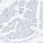 Immunohistochemical staining of human skeletal muscle shows no positivity in myocytes as expected.