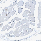 Immunohistochemical staining of human skeletal muscle shows no positivity in myocytes as expected.
