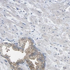 Anti-CMTM1 Antibody