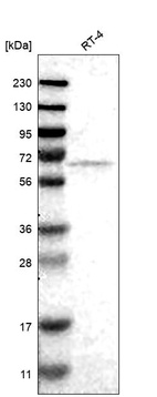 Anti-FKBP10 Antibody