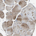 Immunohistochemical staining of human skeletal muscle shows moderate cytoplasmic positivity in myocytes.
