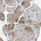 Immunohistochemical staining of human skeletal muscle shows moderate cytoplasmic positivity in myocytes.