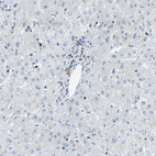 Immunohistochemical staining of human liver shows no positivity in hepatocytes as expected.