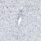 Immunohistochemical staining of human liver shows no positivity in hepatocytes as expected.