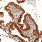 Anti-KIAA1551 Antibody