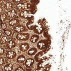Immunohistochemical staining of human rectum shows strong nuclear and cytoplasmic positivity in glandular cells.