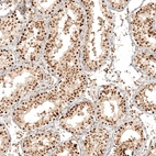 Immunohistochemical staining of human testis shows strong nuclear and cytoplasmic positivity in cells in seminiferous ducts.