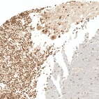 Immunohistochemical staining of human cerebellum shows moderate nuclear and cytoplasmic positivity in Purkinje cells.