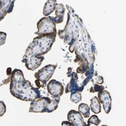 Immunohistochemical staining of human placenta shows 
strong cytoplasmic positivity in trophoblastic cells.